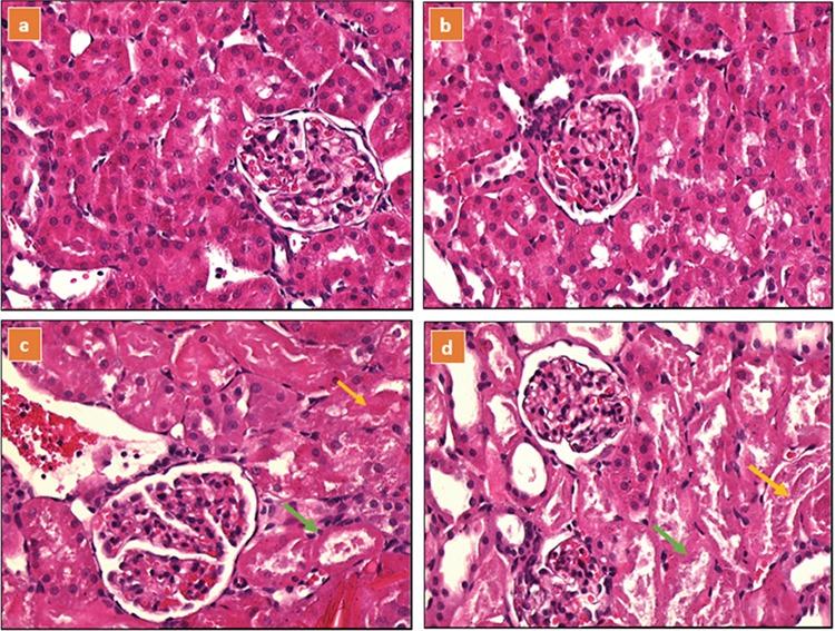 https://cdn.ncbi.nlm.nih.gov/pmc/blobs/7b1b/5820450/e8fa97751ddc/BMJ-35-68-g2.jpg