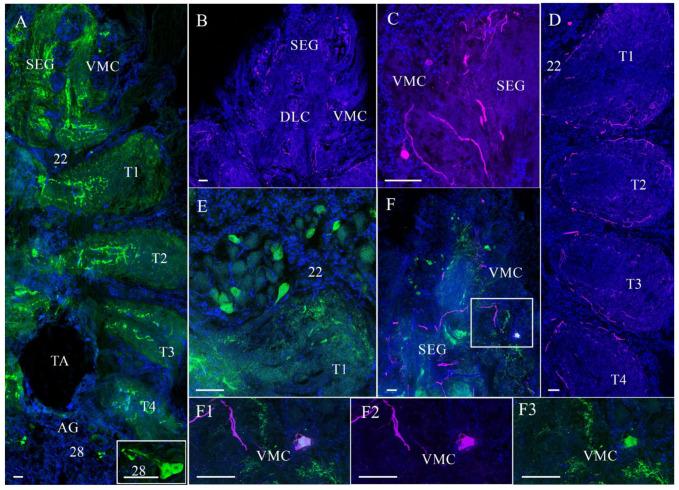 https://cdn.ncbi.nlm.nih.gov/pmc/blobs/7b1c/12154311/c44522b02640/cells-14-00827-g004.jpg