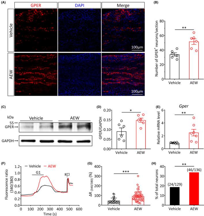 https://cdn.ncbi.nlm.nih.gov/pmc/blobs/7b1d/10848076/a2d7c5aec35e/CNS-30-e14367-g003.jpg