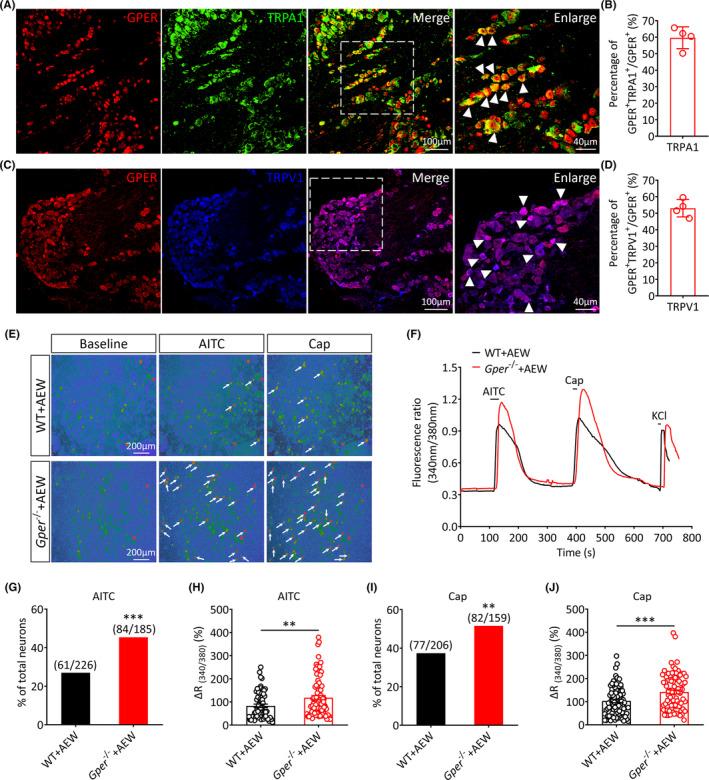 https://cdn.ncbi.nlm.nih.gov/pmc/blobs/7b1d/10848076/d657a70217fa/CNS-30-e14367-g002.jpg