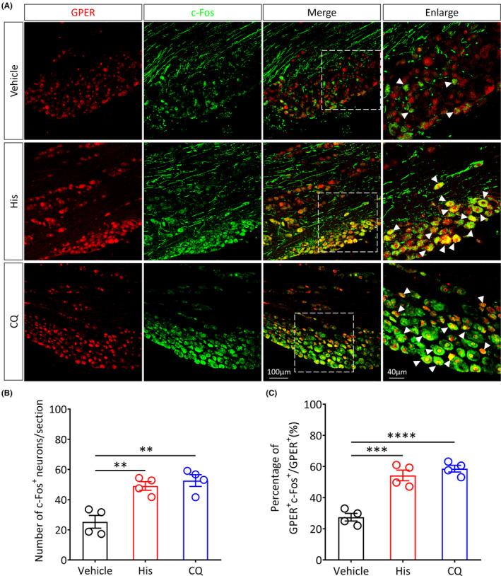https://cdn.ncbi.nlm.nih.gov/pmc/blobs/7b1d/10848076/f351a4779b85/CNS-30-e14367-g006.jpg