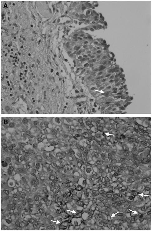 https://cdn.ncbi.nlm.nih.gov/pmc/blobs/7b1e/2361770/16b8215a85a7/92-6602593f7.jpg
