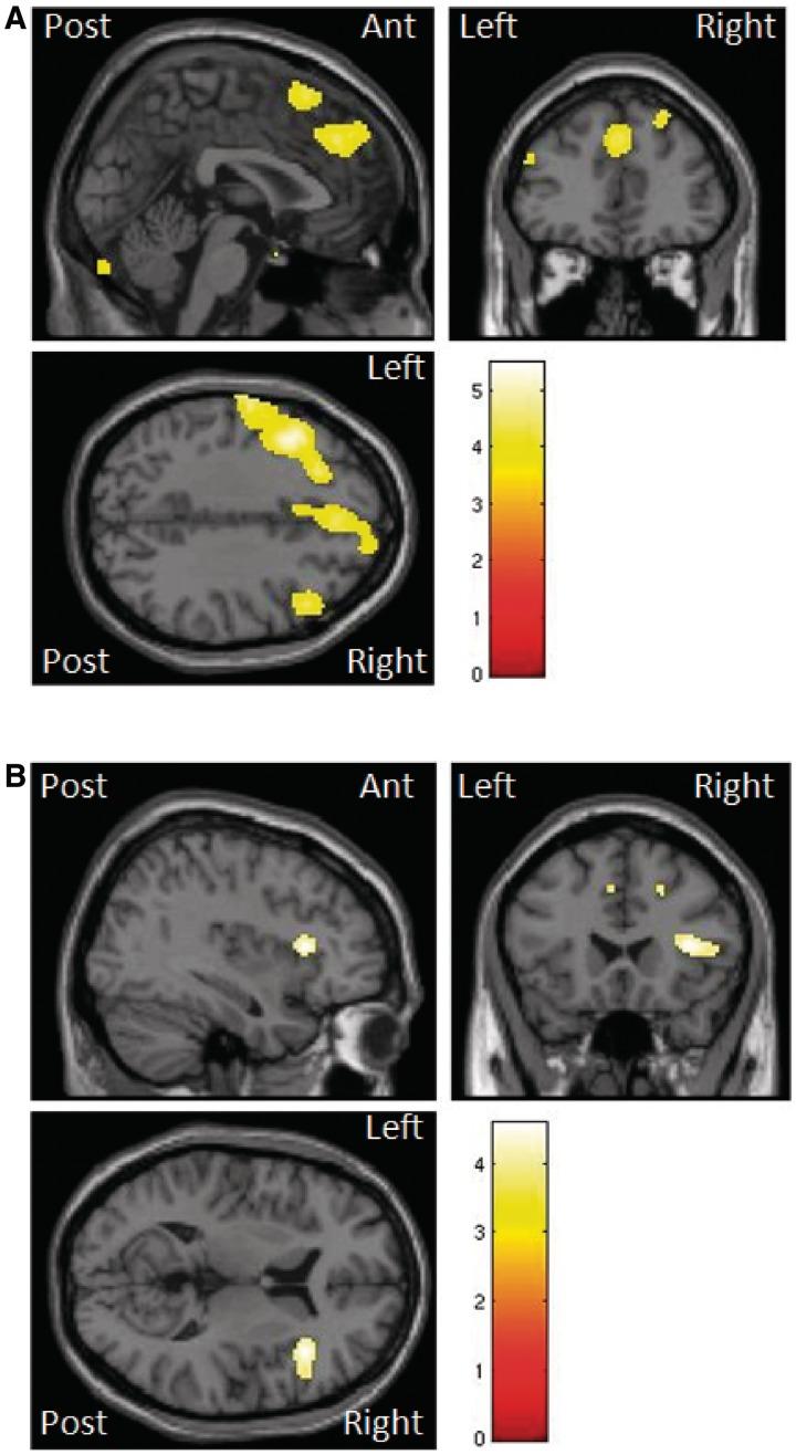 https://cdn.ncbi.nlm.nih.gov/pmc/blobs/7b1e/3381722/a2ffea188882/aws128f5.jpg