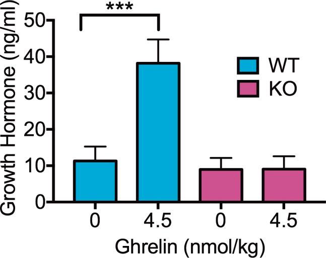 https://cdn.ncbi.nlm.nih.gov/pmc/blobs/7b1f/6066458/4eeb8adb50e3/nihms927212f3.jpg