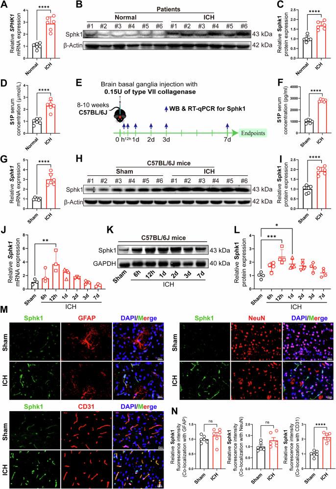 https://cdn.ncbi.nlm.nih.gov/pmc/blobs/7b21/11666774/75da6f3887b0/41419_2024_7310_Fig1_HTML.jpg