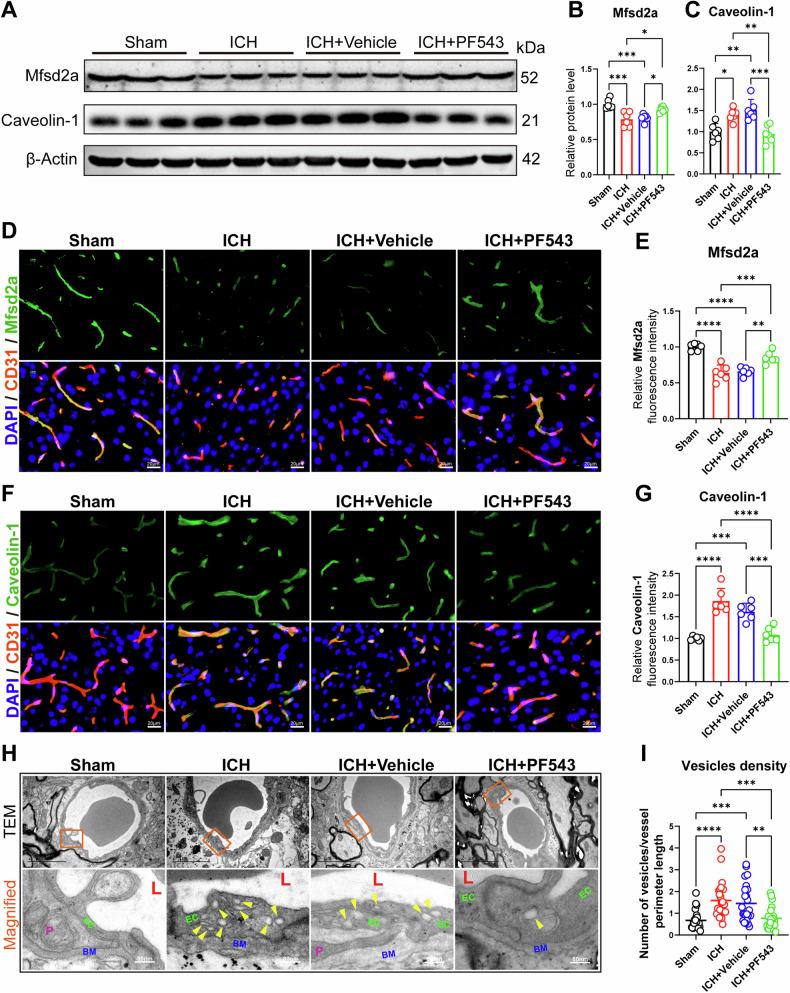 https://cdn.ncbi.nlm.nih.gov/pmc/blobs/7b21/11666774/93701982a5a8/41419_2024_7310_Fig4_HTML.jpg