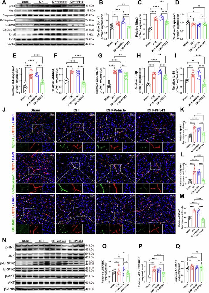 https://cdn.ncbi.nlm.nih.gov/pmc/blobs/7b21/11666774/b11bc4e166d8/41419_2024_7310_Fig6_HTML.jpg