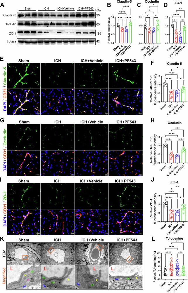 https://cdn.ncbi.nlm.nih.gov/pmc/blobs/7b21/11666774/c572366dd219/41419_2024_7310_Fig3_HTML.jpg