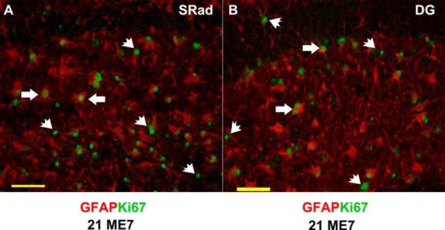 https://cdn.ncbi.nlm.nih.gov/pmc/blobs/7b21/3924314/590e23b07221/zbc0111475460005.jpg