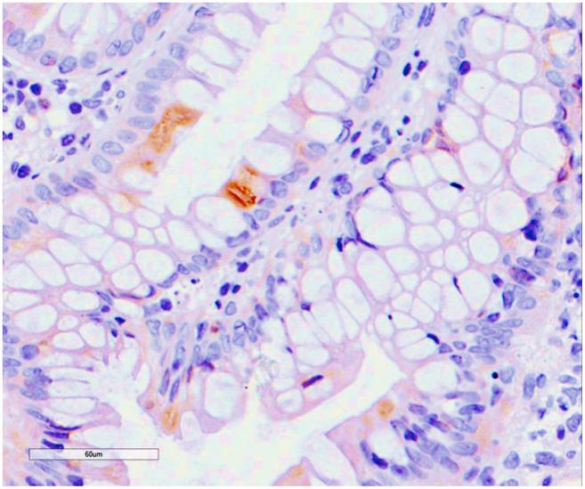https://cdn.ncbi.nlm.nih.gov/pmc/blobs/7b22/7803550/c86b6b87c4f0/aging-12-202345-g006.jpg