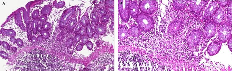 https://cdn.ncbi.nlm.nih.gov/pmc/blobs/7b22/7803550/d2f1a3c87a9f/aging-12-202345-g002.jpg