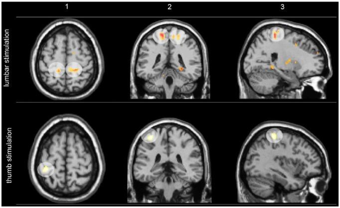 https://cdn.ncbi.nlm.nih.gov/pmc/blobs/7b25/6900582/06e7fb9a9e34/10.1177_1073858418809074-fig3.jpg