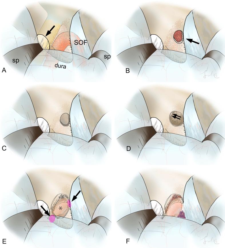 https://cdn.ncbi.nlm.nih.gov/pmc/blobs/7b2e/9918798/c6012ae2d32d/gr1.jpg