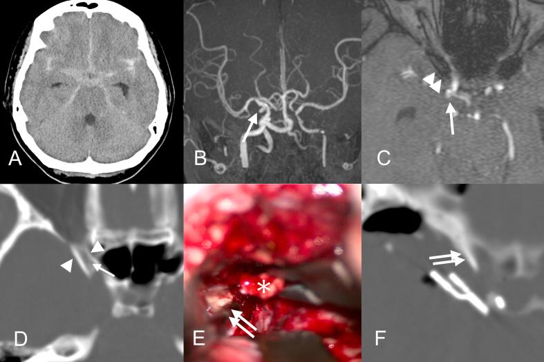 https://cdn.ncbi.nlm.nih.gov/pmc/blobs/7b2e/9918798/f6a04febd292/gr3.jpg