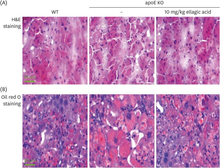 https://cdn.ncbi.nlm.nih.gov/pmc/blobs/7b35/10995779/48f2984829be/nrp-18-194-g005.jpg