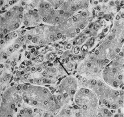https://cdn.ncbi.nlm.nih.gov/pmc/blobs/7b38/1804703/955b6232d7c0/bullnyacadmed00330-0035-a.jpg