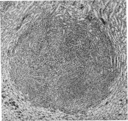 https://cdn.ncbi.nlm.nih.gov/pmc/blobs/7b38/1804703/a21c220b4b29/bullnyacadmed00330-0038-a.jpg