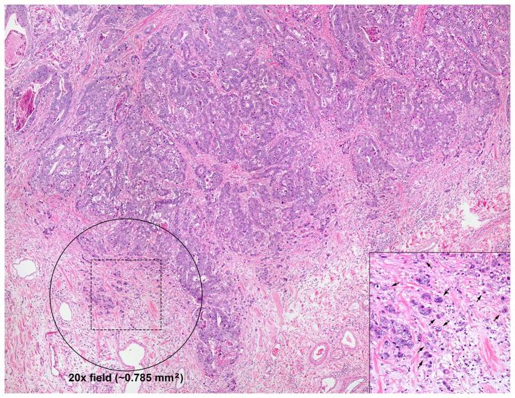 https://cdn.ncbi.nlm.nih.gov/pmc/blobs/7b4f/4209206/7454a98ff026/nihms570730f1.jpg