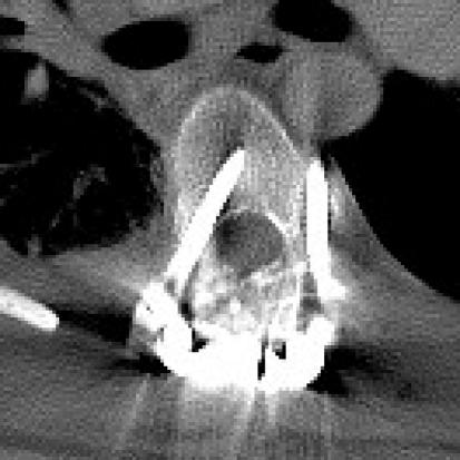 https://cdn.ncbi.nlm.nih.gov/pmc/blobs/7b52/2899961/23a4fbc529f5/586_2010_1293_Fig2_HTML.jpg