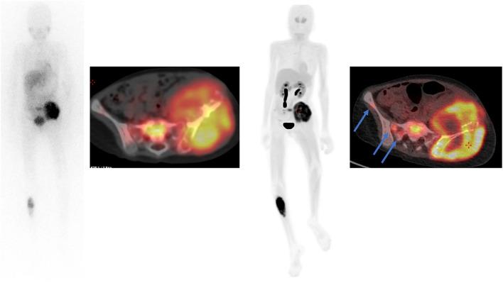 https://cdn.ncbi.nlm.nih.gov/pmc/blobs/7b5b/10796700/484f743bb021/259_2023_6486_Fig3_HTML.jpg