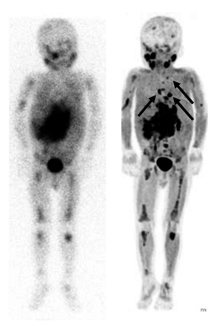 https://cdn.ncbi.nlm.nih.gov/pmc/blobs/7b5b/10796700/77f64e73fa36/259_2023_6486_Fig2_HTML.jpg