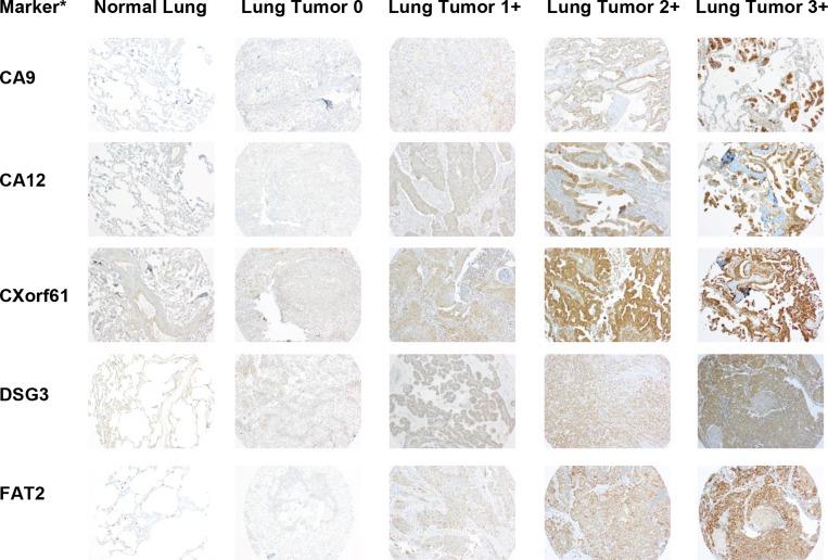 https://cdn.ncbi.nlm.nih.gov/pmc/blobs/7b5e/5768334/71bce6f320ad/oncotarget-08-113373-g003.jpg