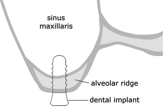 https://cdn.ncbi.nlm.nih.gov/pmc/blobs/7b5e/7878229/11db61175e2c/784_2020_3432_Fig1_HTML.jpg