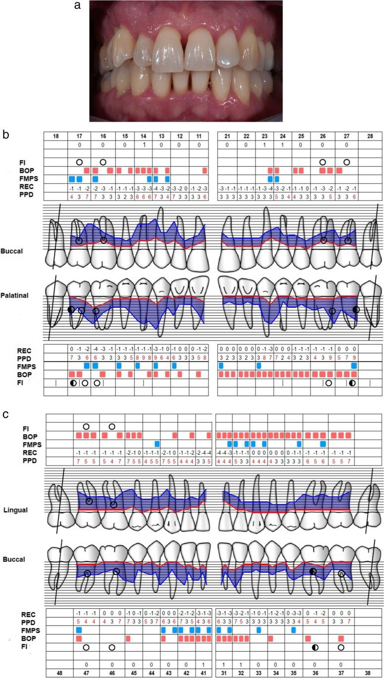 https://cdn.ncbi.nlm.nih.gov/pmc/blobs/7b5f/10160166/009556e21603/784_2023_4994_Fig2_HTML.jpg