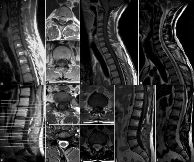 https://cdn.ncbi.nlm.nih.gov/pmc/blobs/7b61/3475877/480940297cf6/SNI-3-102-g002.jpg