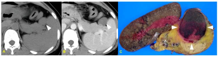 https://cdn.ncbi.nlm.nih.gov/pmc/blobs/7b63/11596154/78d286a3ae2f/medicina-60-01766-g009.jpg