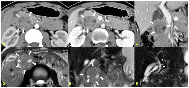 https://cdn.ncbi.nlm.nih.gov/pmc/blobs/7b63/11596154/b4aa636e243f/medicina-60-01766-g003.jpg