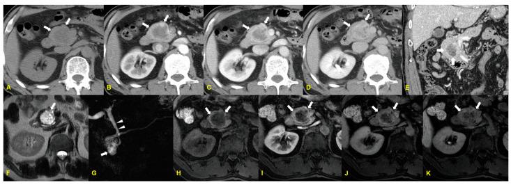 https://cdn.ncbi.nlm.nih.gov/pmc/blobs/7b63/11596154/c9e0efb3d972/medicina-60-01766-g001.jpg