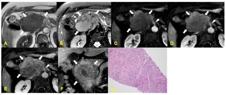 https://cdn.ncbi.nlm.nih.gov/pmc/blobs/7b63/11596154/d3863e3210aa/medicina-60-01766-g010.jpg