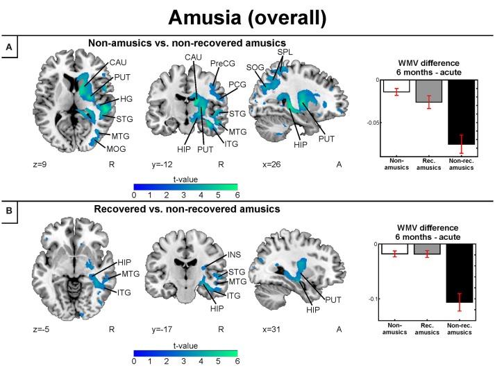 https://cdn.ncbi.nlm.nih.gov/pmc/blobs/7b63/5524924/abae17e47edd/fnins-11-00426-g0005.jpg