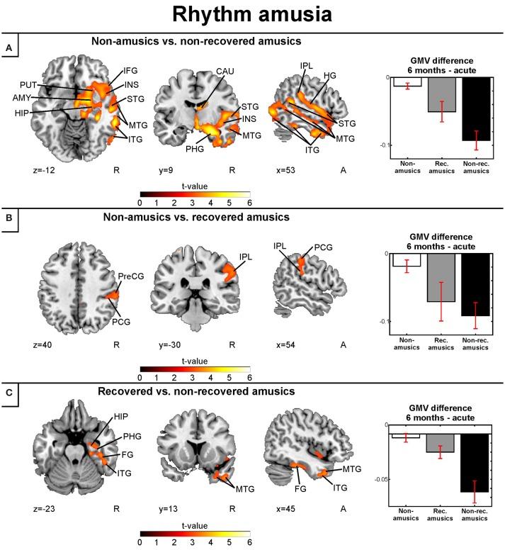 https://cdn.ncbi.nlm.nih.gov/pmc/blobs/7b63/5524924/fafc023eb610/fnins-11-00426-g0007.jpg