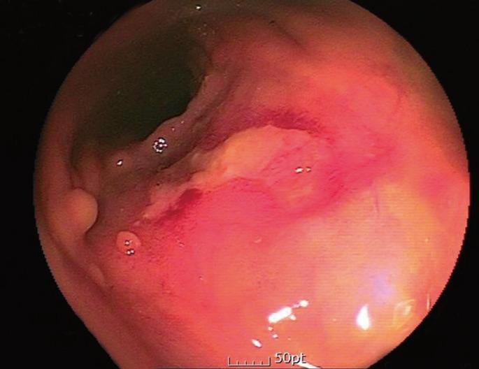 https://cdn.ncbi.nlm.nih.gov/pmc/blobs/7b67/3548149/e857a4b24dfe/jksc-28-325-g005.jpg