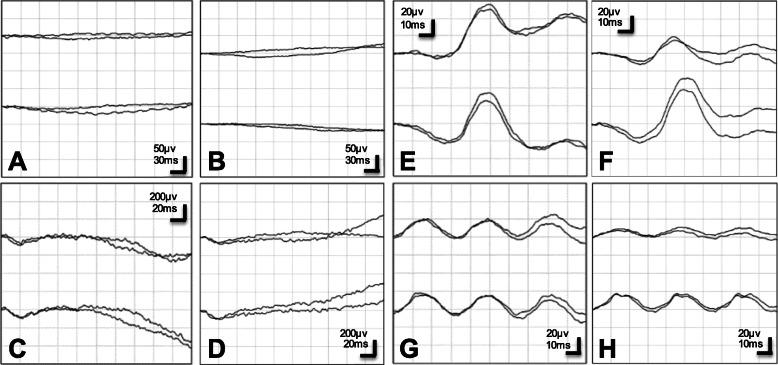 https://cdn.ncbi.nlm.nih.gov/pmc/blobs/7b68/7599286/3f5d9abff133/12348_2020_219_Fig4_HTML.jpg