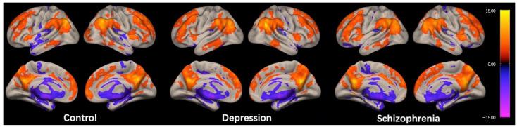 https://cdn.ncbi.nlm.nih.gov/pmc/blobs/7b69/10377532/d9ae051b857d/brainsci-13-00997-g001.jpg