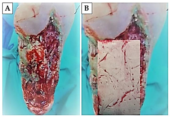 https://cdn.ncbi.nlm.nih.gov/pmc/blobs/7b6e/11313444/d5254a2da322/ijms-25-08388-g010.jpg