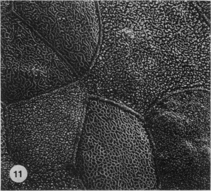 https://cdn.ncbi.nlm.nih.gov/pmc/blobs/7b6f/2041687/2b93421cc560/brjexppathol00111-0024-e.jpg