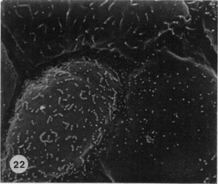 https://cdn.ncbi.nlm.nih.gov/pmc/blobs/7b6f/2041687/2e5a106e9d04/brjexppathol00111-0027-e.jpg
