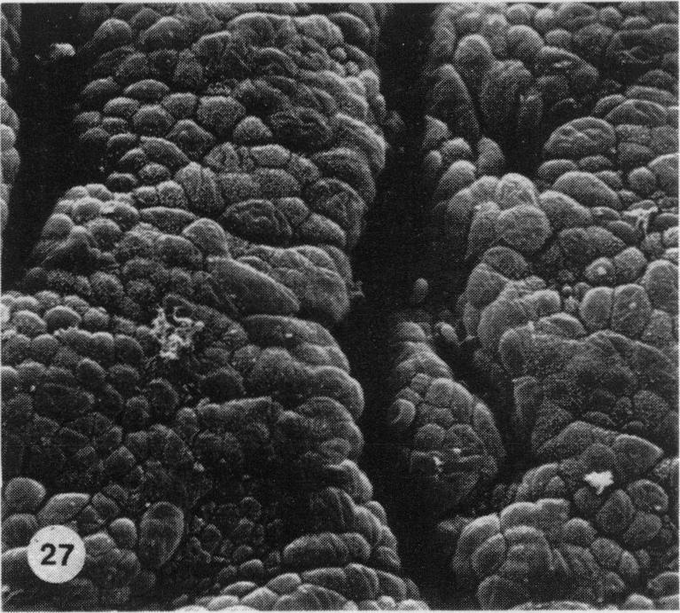 https://cdn.ncbi.nlm.nih.gov/pmc/blobs/7b6f/2041687/6a90a9794e94/brjexppathol00111-0029-d.jpg