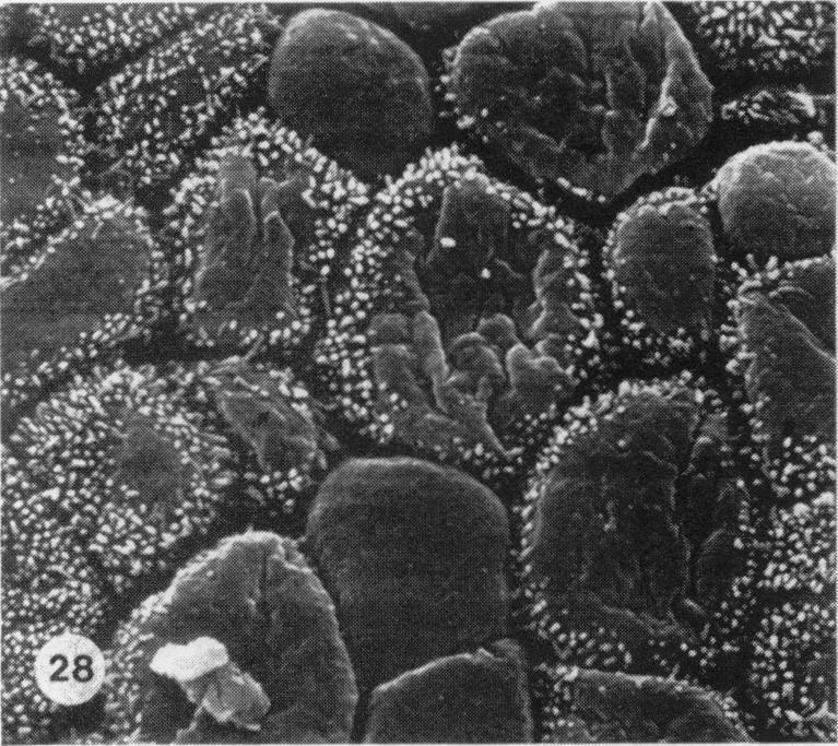 https://cdn.ncbi.nlm.nih.gov/pmc/blobs/7b6f/2041687/9044ca7684c0/brjexppathol00111-0029-e.jpg