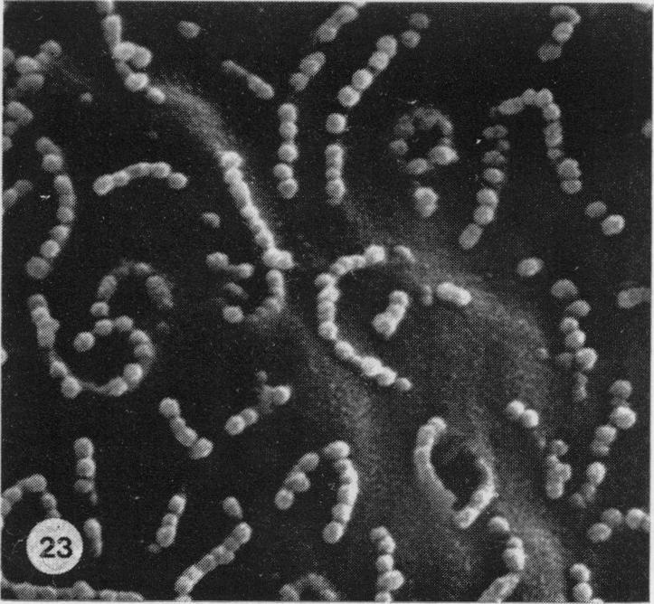 https://cdn.ncbi.nlm.nih.gov/pmc/blobs/7b6f/2041687/a0ed40a5f324/brjexppathol00111-0027-f.jpg