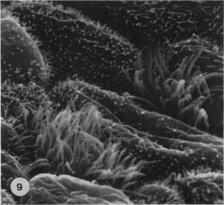 https://cdn.ncbi.nlm.nih.gov/pmc/blobs/7b6f/2041687/aa253a741263/brjexppathol00111-0024-c.jpg