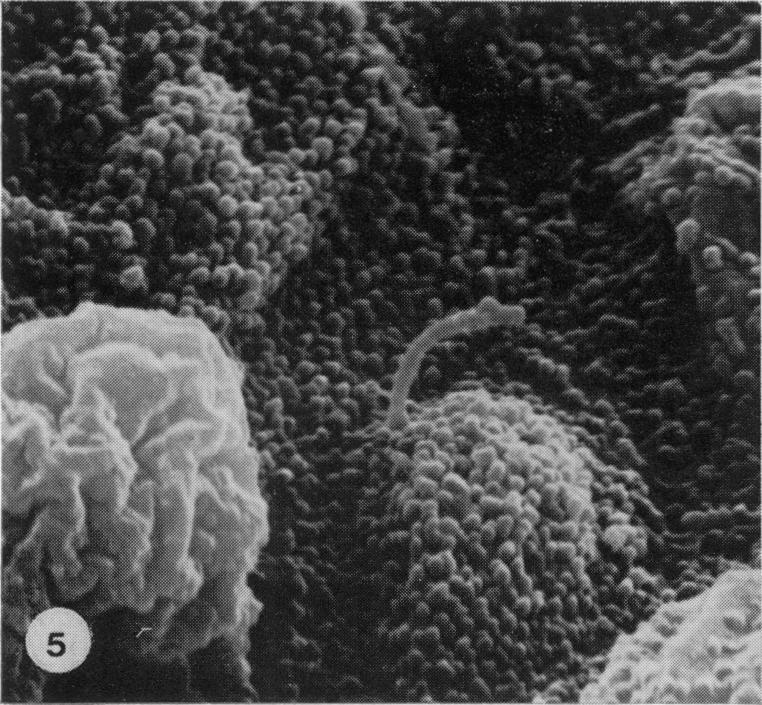 https://cdn.ncbi.nlm.nih.gov/pmc/blobs/7b6f/2041687/dd3942911061/brjexppathol00111-0023-e.jpg