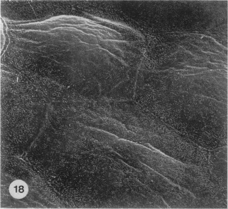 https://cdn.ncbi.nlm.nih.gov/pmc/blobs/7b6f/2041687/fc1176f07dcd/brjexppathol00111-0027-a.jpg