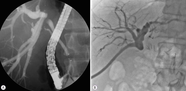 https://cdn.ncbi.nlm.nih.gov/pmc/blobs/7b70/7280848/a2d8a9120a58/ce-2020-095f1.jpg