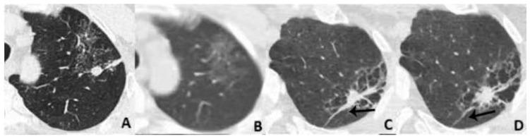 https://cdn.ncbi.nlm.nih.gov/pmc/blobs/7b71/10340214/4feed7d9e753/diagnostics-13-02210-g005.jpg