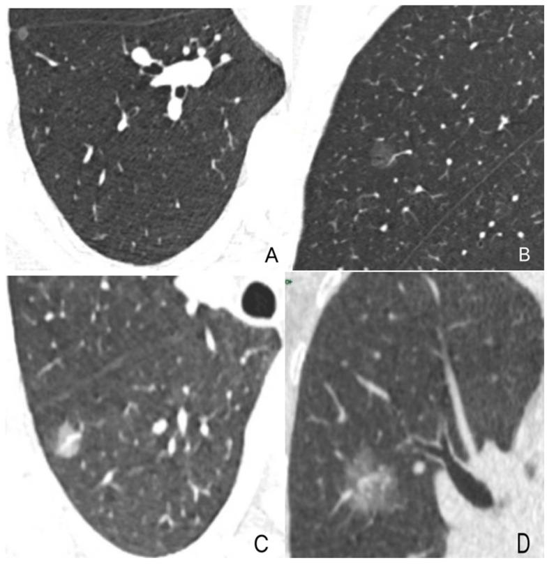 https://cdn.ncbi.nlm.nih.gov/pmc/blobs/7b71/10340214/c2f150087e8c/diagnostics-13-02210-g002.jpg